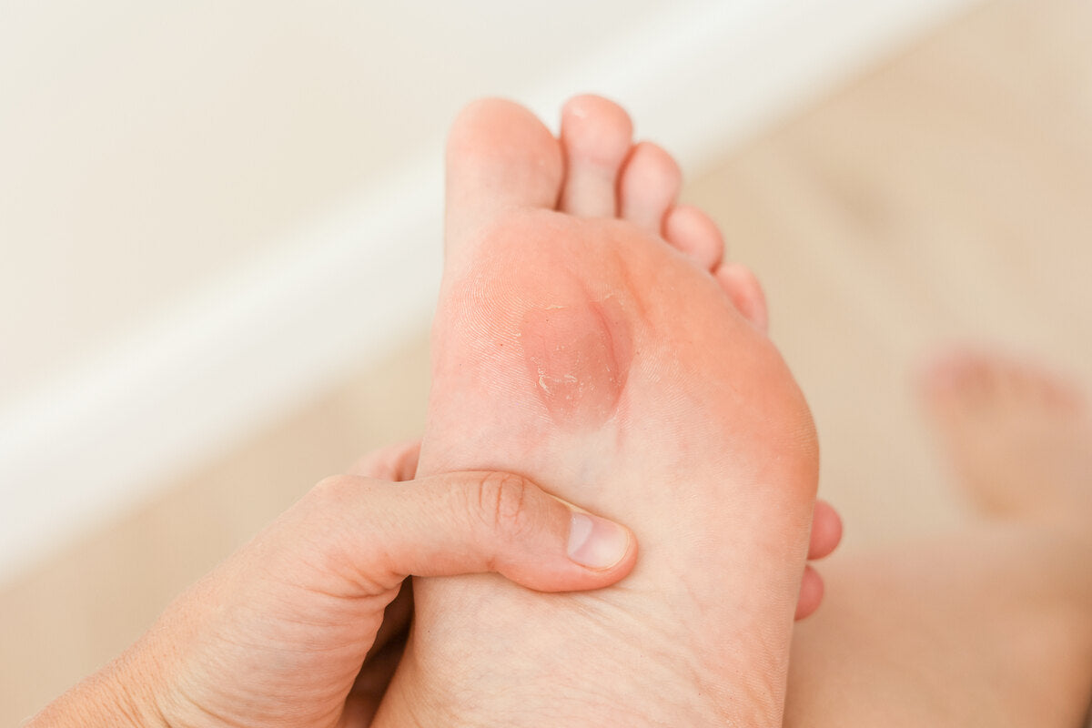 How to Remove Callus on Big Toe: Simple Steps for Softening and Removing  Dead Skin